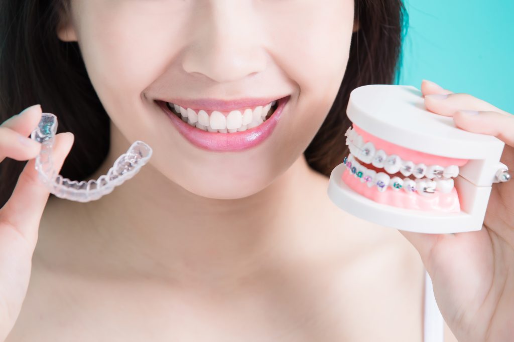 Straight Talk: Invisalign First for Early Orthodontic Treatment